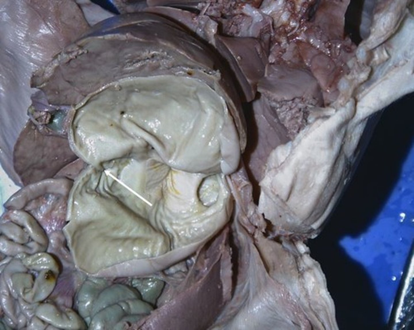 <p>ring of muscle that guards the opening between the stomach and the duodenum</p>