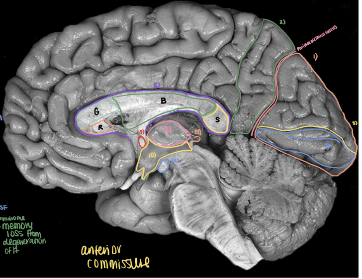 <p>What is number 13?</p>