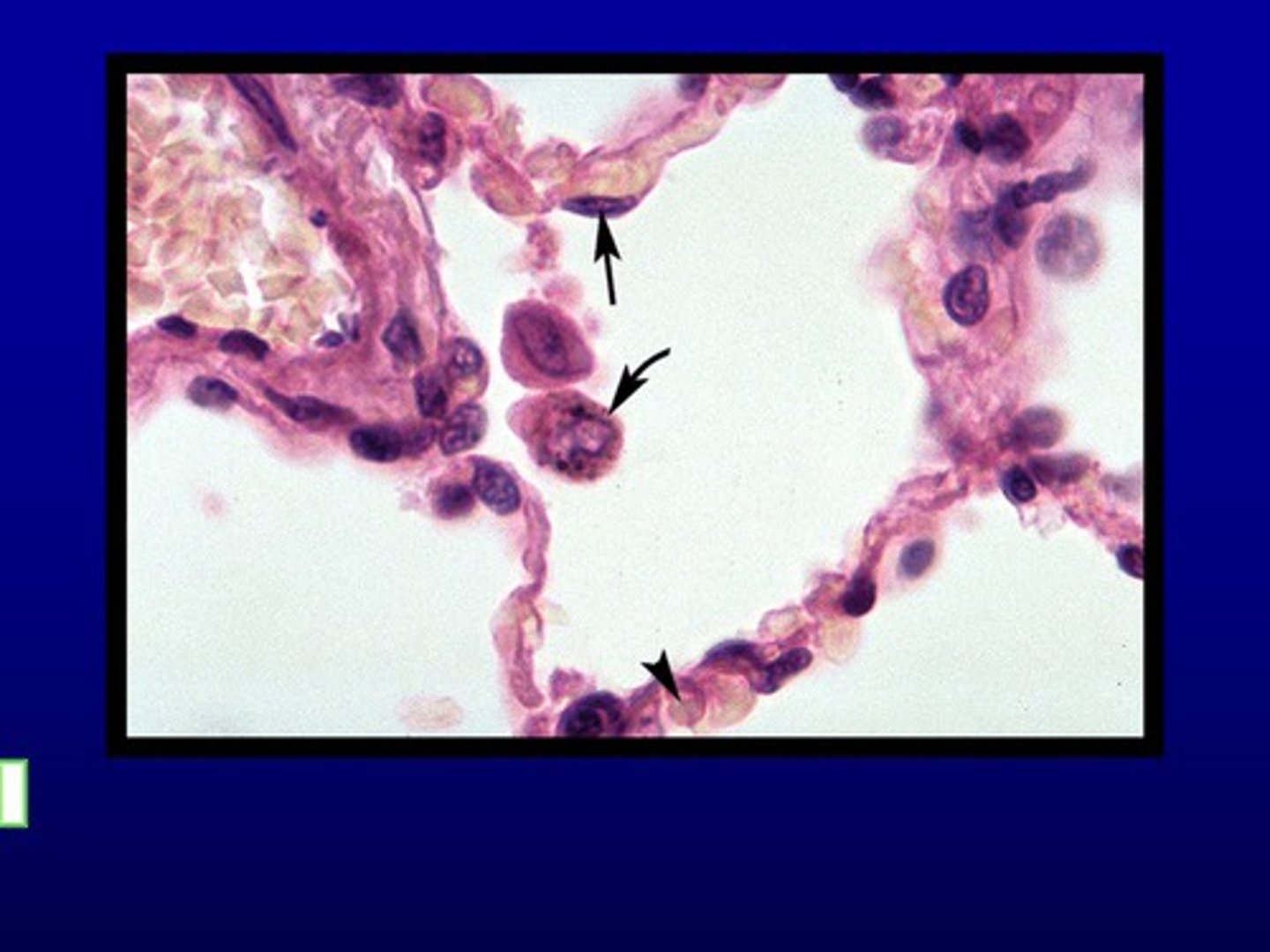 <p>Immune cells that engulf particles reaching the alveoli.</p>
