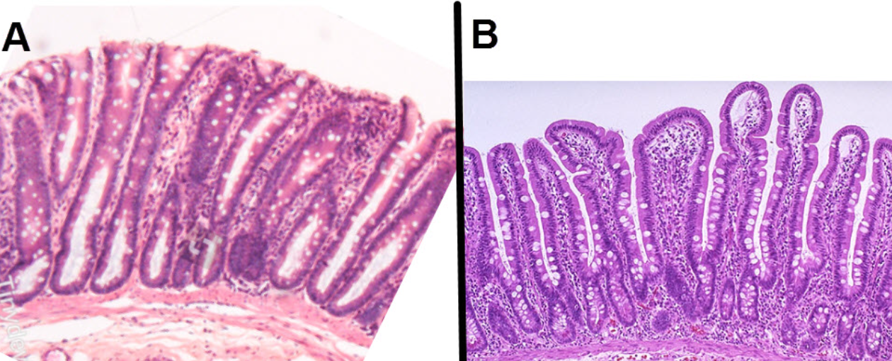 <p>These 2 images have similar magnifications. Which of the 2 micrographs represents the colonic mucosa?</p>