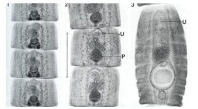 <p>which tapeworm is this?</p>