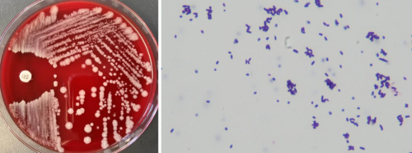 <p>non-hemolytic</p><p>club, palisading bacilli (Chinese letters)</p>