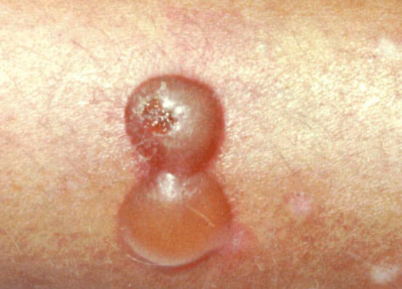 <p>Bulla</p>