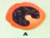 <p>Identify the WBC</p>
