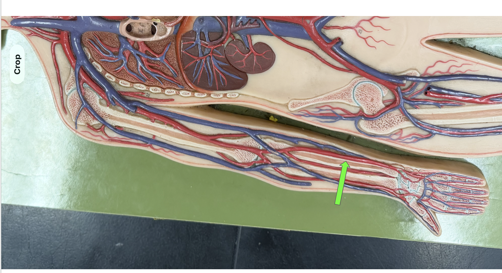 <p>What artery is this </p>