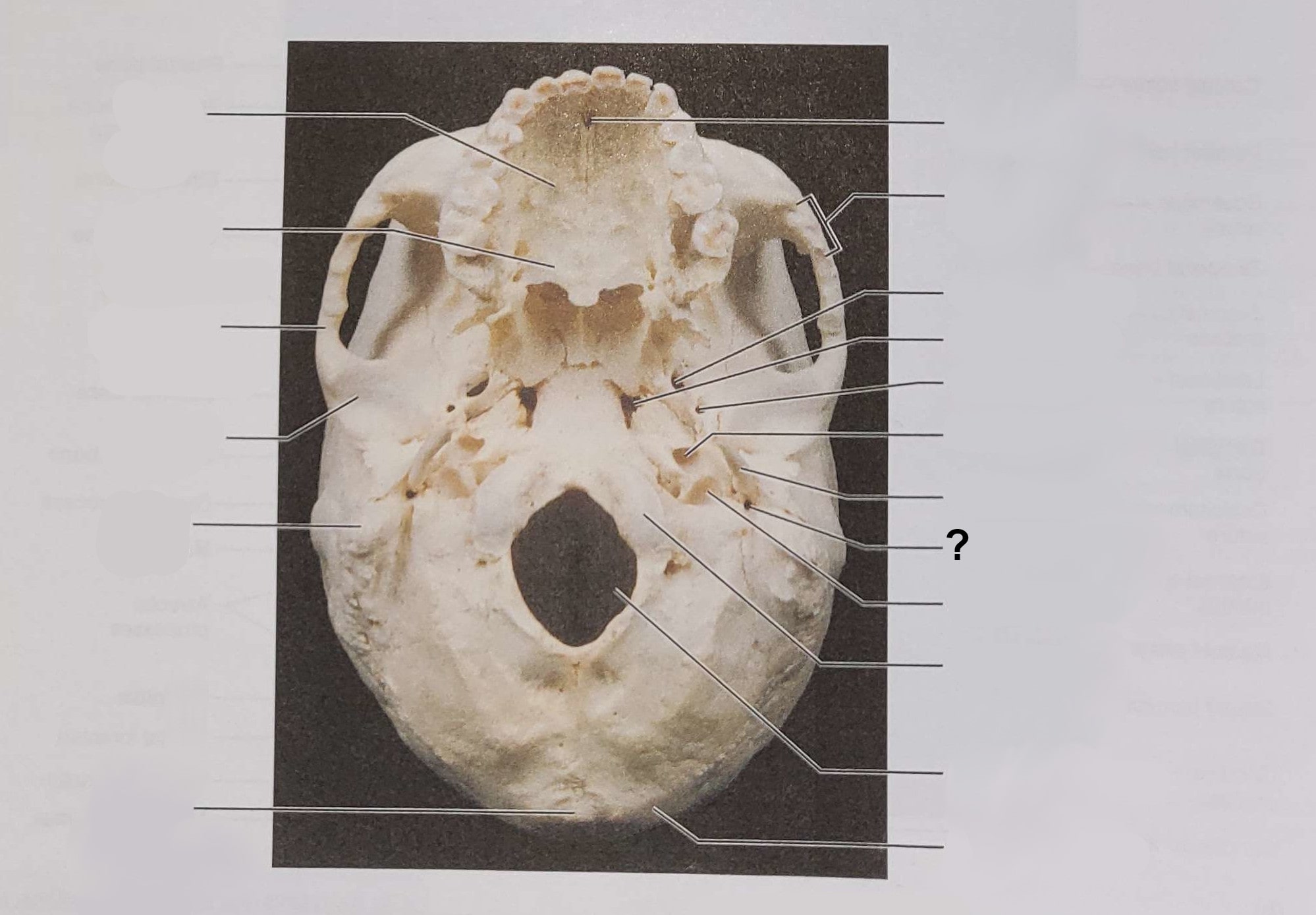 <p>Name the indicated structure</p>