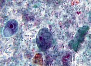 Iodamoeba butschlii trophozoite