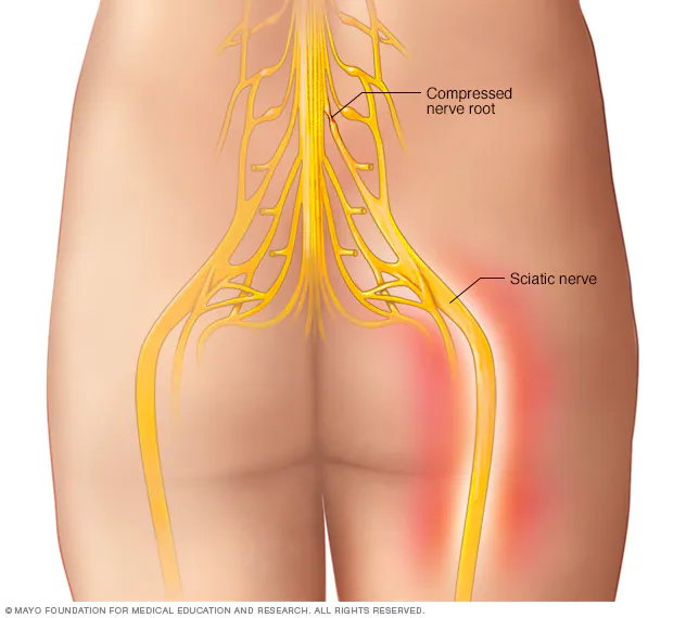 <ul><li><p>Tibial Nerve</p></li><li><p>Common Fibular Nerve</p></li><li><p>Deep Fibular nerve</p></li><li><p>Superficial Fibular Nerve</p></li></ul><p></p>