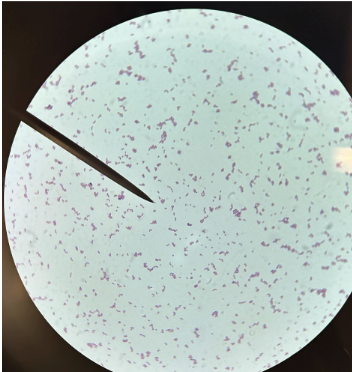 <p>gram positive cocci: </p>
