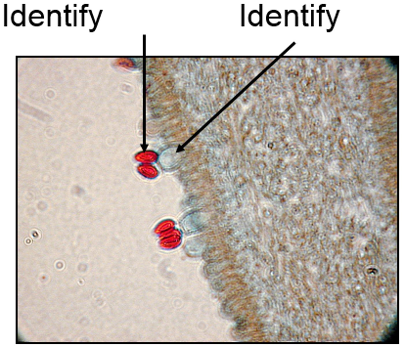 <p>Club-shaped, reproductive structure in which club fungi produce 4 external basidiospores. Characteristic of basidiomycota</p>