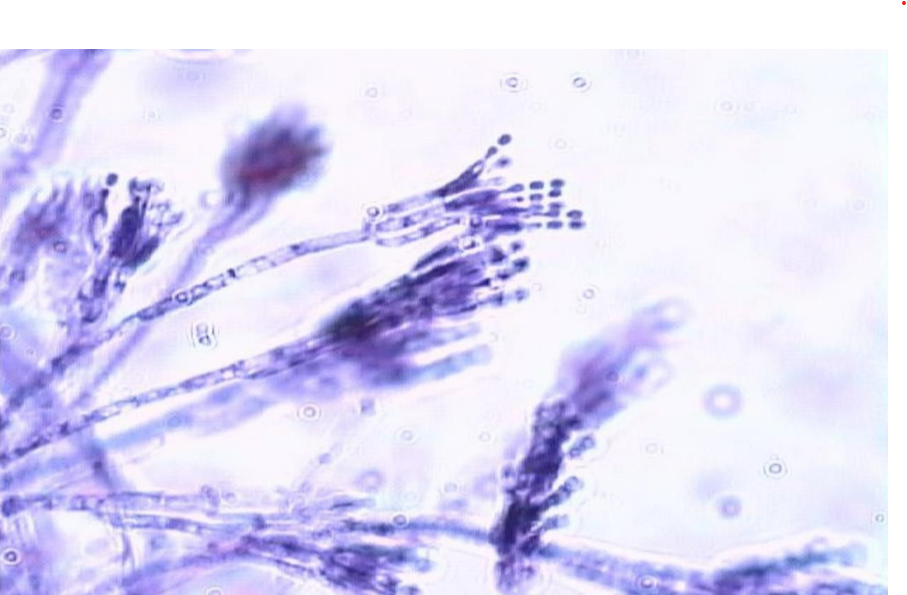 <p>What is the genus name of this organism?</p><p>What name is given to this spore-bearing structure?</p>