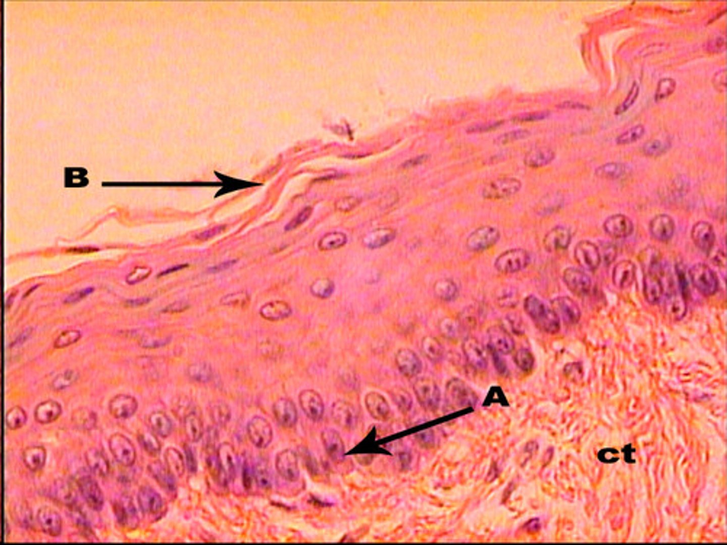<p>in layers, flat, scale-like, surface cells are shed and replaced</p><p>keratinized-packed with keratin, makes cells tough and water resistant</p><p>found in epidermis (surface layer of skin), mucous membranes (line body openings-mouth, throat, esophagus, rectum, vagina, anus)</p><p>(deeper cells are cuboid or columnar)</p>
