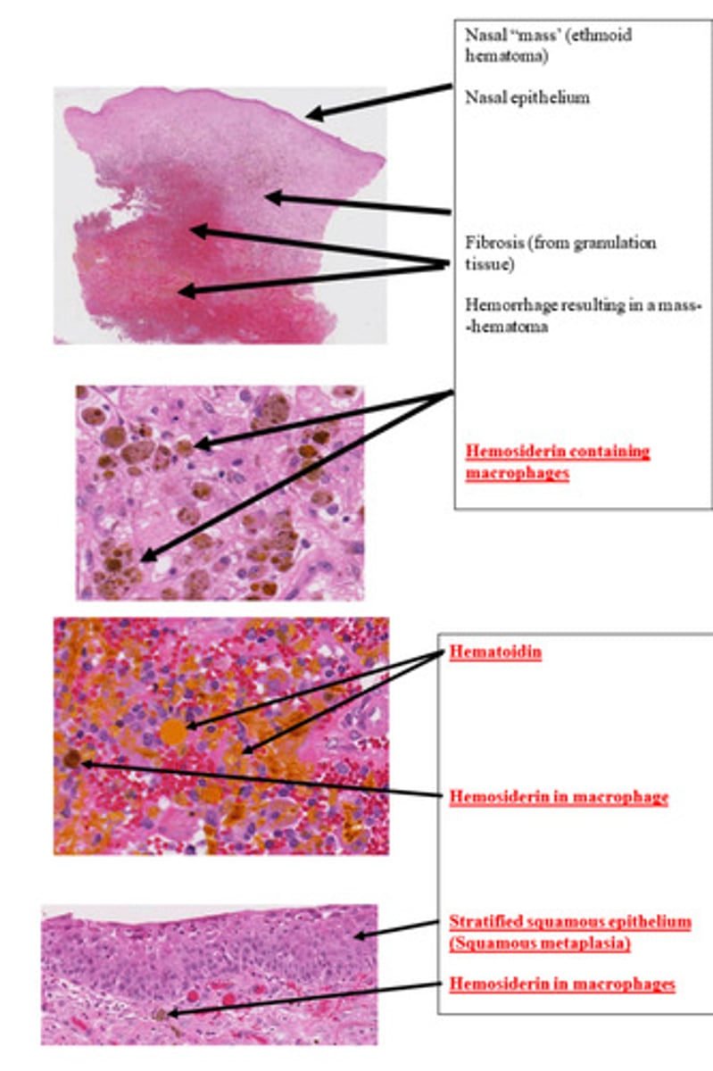 <p>What is the lesion?</p>
