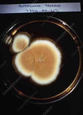 <p><em>Aspergillus terreus</em></p>