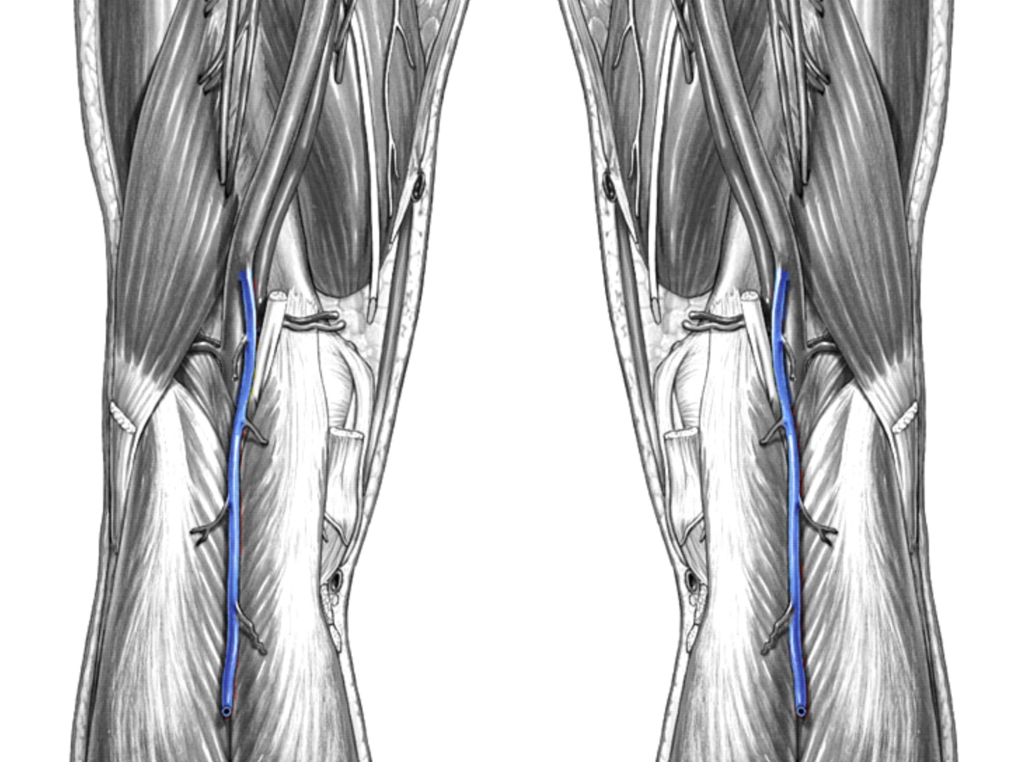 <p>Which veins:</p><ul><li><p>Extends from popliteal vein</p></li><li><p>On posterior calf</p></li></ul><p></p>