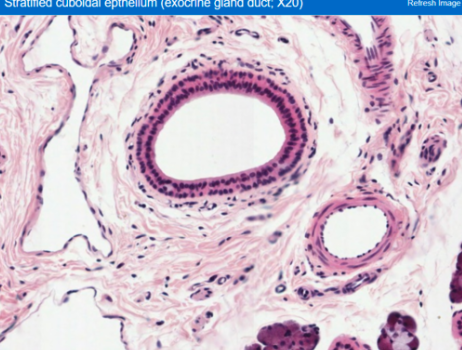 <ul><li><p>lines the ducts of glands - salivary</p></li><li><p>uncommon type of epithelium, has very limited distribution</p><p></p></li></ul><p></p>
