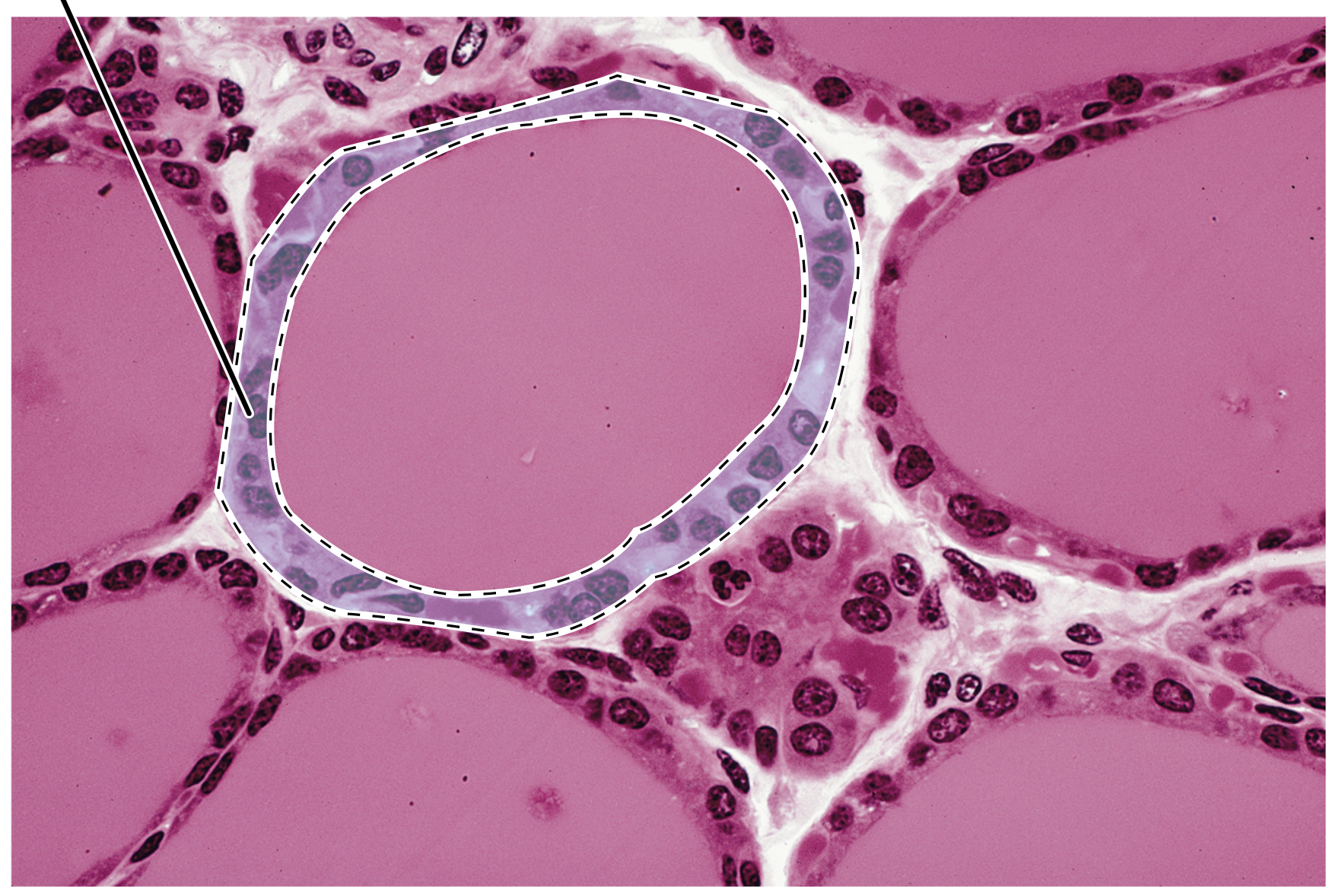 <p>Name the highlighted tissue.</p>
