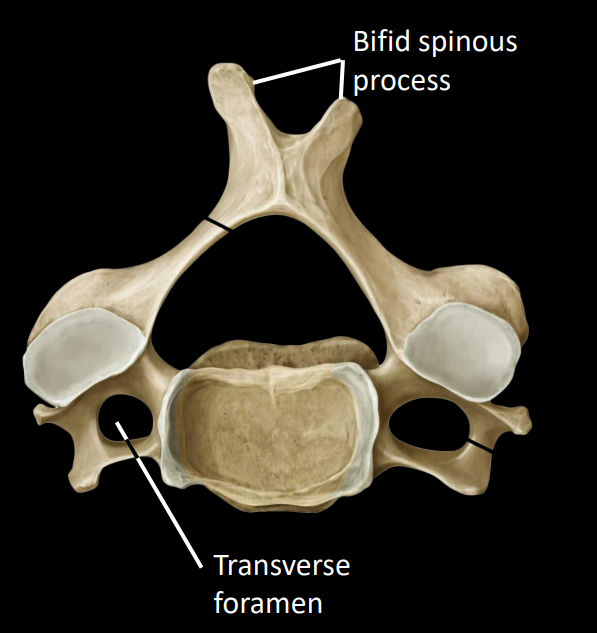 <p>obliquely transverse (slanted) facet joints, allows for:</p><ul><li><p>flexion/extension</p></li><li><p>lateral flexion</p></li><li><p>rotation</p></li></ul><p><strong>triangular spinal foramen</strong> - larger as spinal cord is thickest here</p><p><strong>bifid spinous process</strong></p><p><strong>transverse foramen</strong> - houses the vertebral artery, supplies blood to brain stem</p>