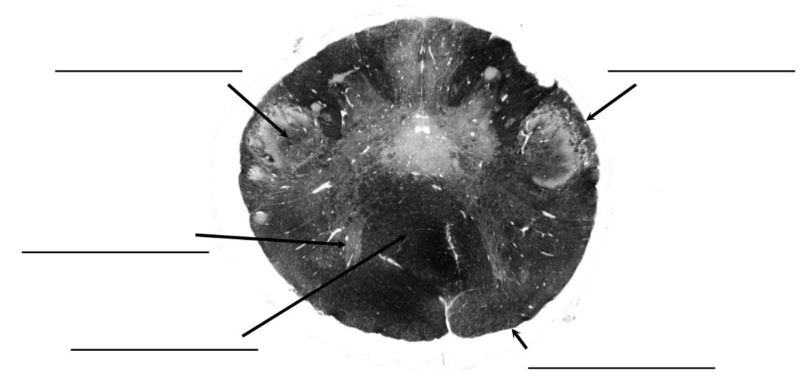 <p>identify this spinal level</p>