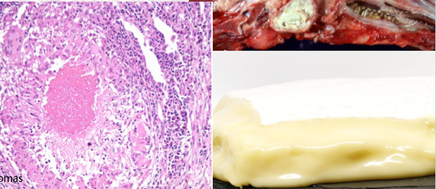 <p>subtype of lytic necrosis </p><p></p><p>mycobacterial granulomas </p>
