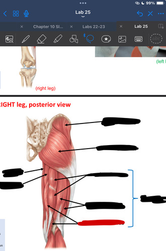 <p>What muscle is this?</p>