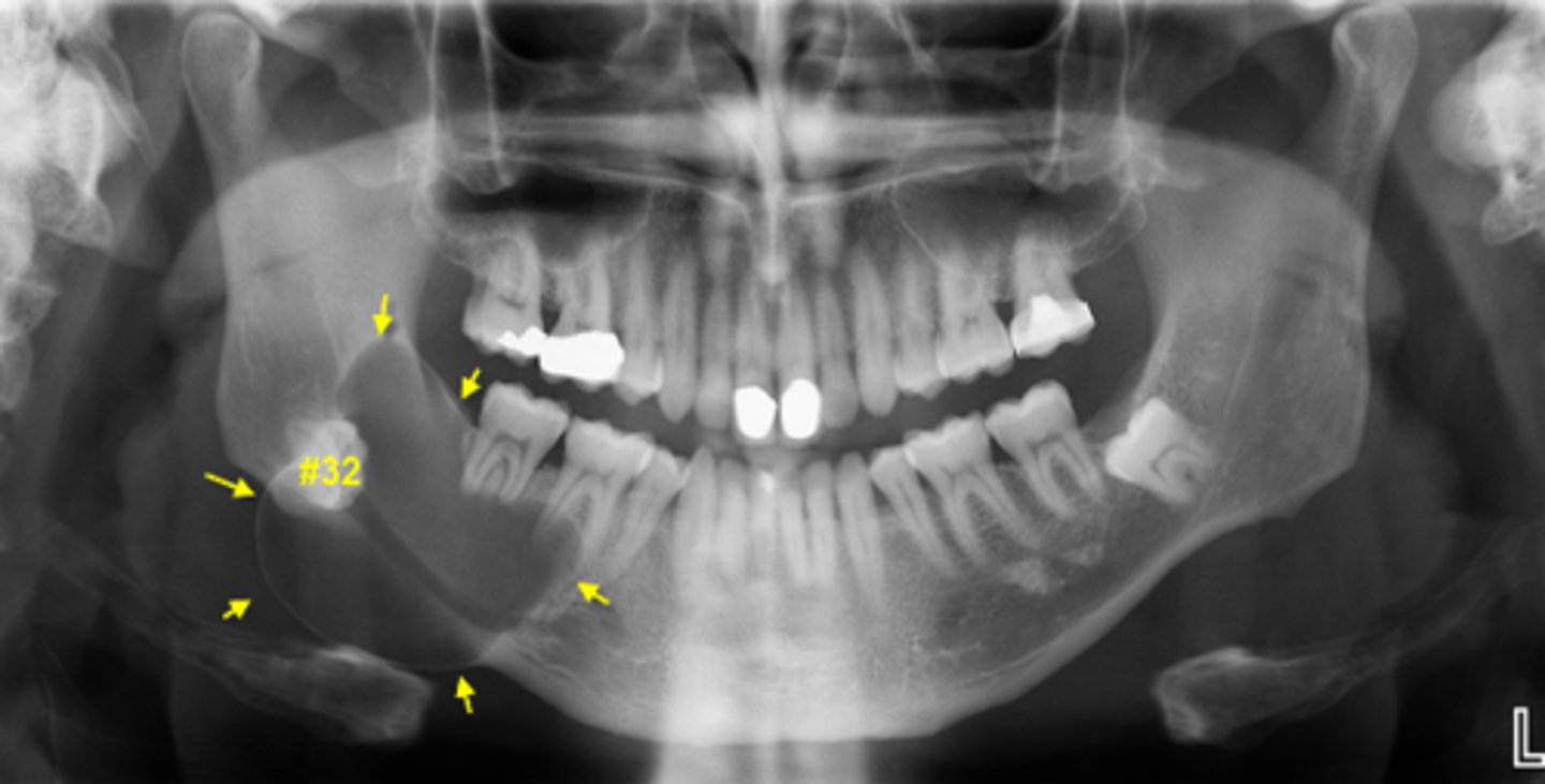 <p>ID the cyst:</p>