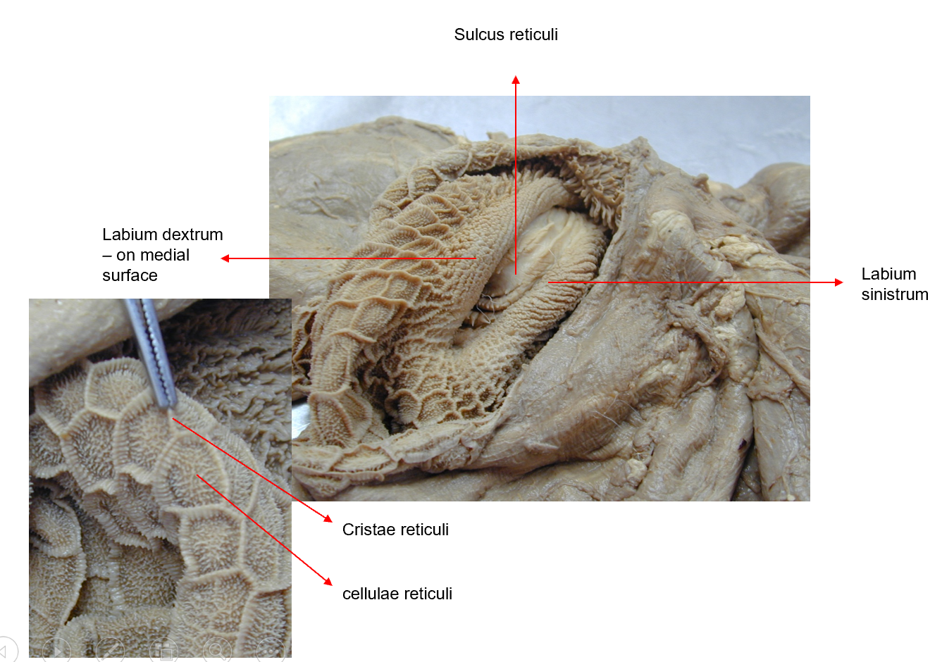 <p>Reticulum - spherical, to the left, bw. diaphragm + rumen. Has facies diaphragmatica et visceralis. </p><ol><li><p><strong>crista reticuli</strong> - formed by non-glandular mucosa</p></li><li><p><strong>cellulae reticuli </strong></p></li><li><p>on the crests and cells there are small <strong>papillae reticuli. </strong></p></li></ol><p>The reticulum communicates with omasum through the ostium reticulo-omasicum. </p>