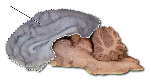 <p>Name the highlighted part of the brain.</p>