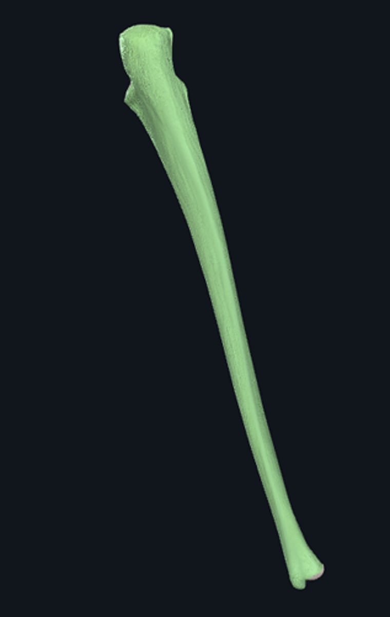 <p>right or left?</p>