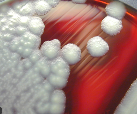 <p>col: large, spreading, gray-white, irregular margins; many beta-hemo</p><p>GPR (easily overdecolorized)</p><p>mostly catalase = pos<br></p><p>speciation is based on cell morph, size, spore shape/location, biochem test</p>