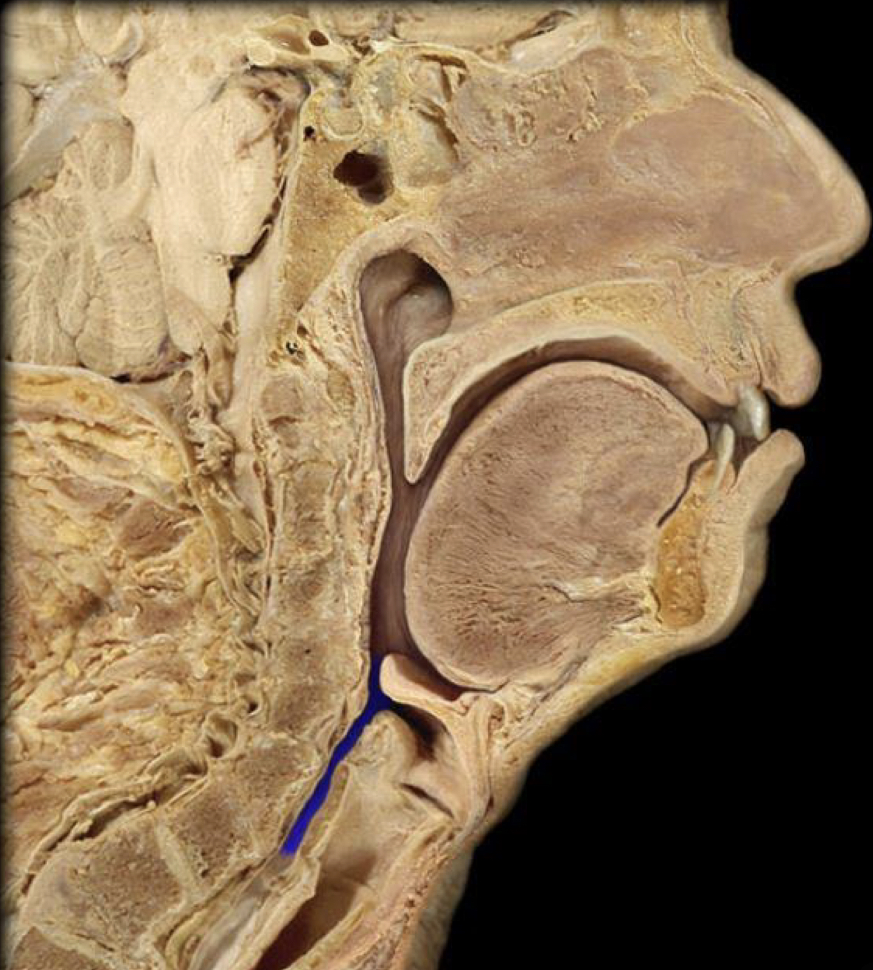 What structure is highlighted in blue?