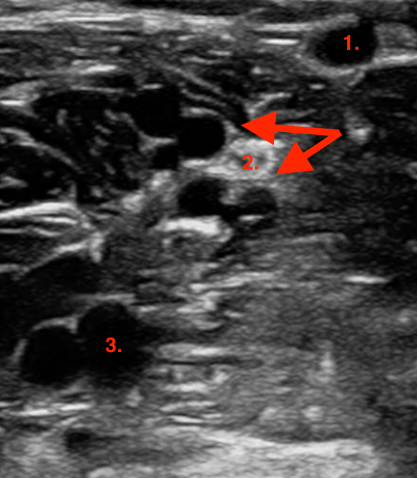 <p>Identify this image. </p>
