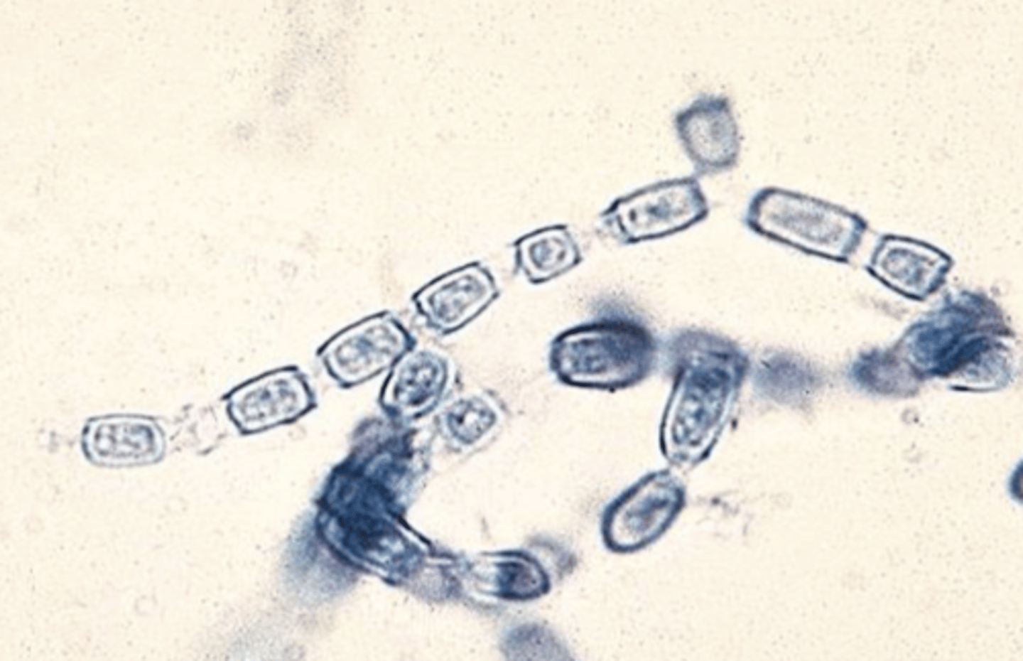 <p>-cottonly white mold form in culture</p><p>-high risk for labs cause arthroconidia aerosolize easily</p><p>-identify with MALDI</p><p>-used to be a potential bioterrorism agent</p><p>YEAST: spherules with many endospores inside</p><p>-MOLD: barrel-shaped arthroconidia and alternate between disjunctor cells that fracture easily</p><p>CULTURE: cottonly mold that can grow on SBA</p><p>-was a bioterrorism agent until 2012 when they said easier to just go to AZ and get soil than steal from our lab LOL</p>