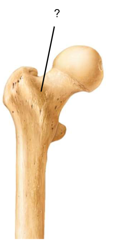 <p>Nom et caractéristiques de ce relief ?</p>