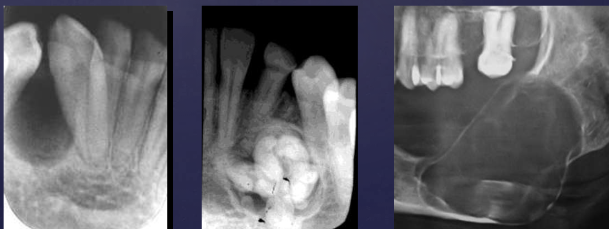 <p>Well-defined</p><p><span data-name="black_small_square" data-type="emoji">▪</span> Smooth, regular</p><p><span data-name="black_small_square" data-type="emoji">▪</span> Mostly corticated</p>