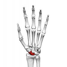 <p><span>thumb side of the wrist, between hand and forearm, on lateral side</span></p>