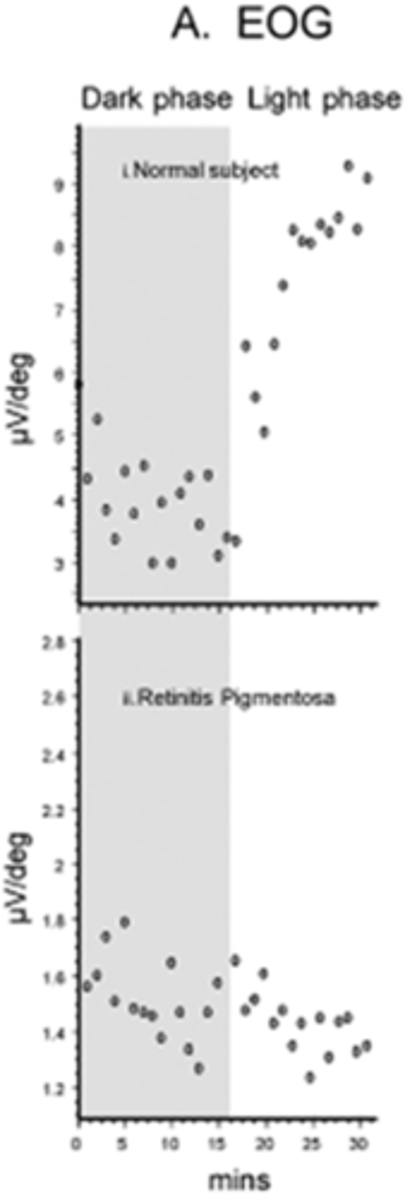 <p>How do we calculate the <strong>Arden ratio</strong> in <strong>EOG</strong>?</p>
