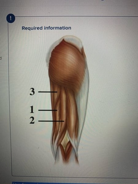 <p>Semitendinosus</p>