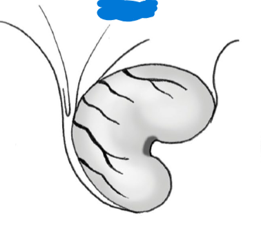 <p>identify species w/ this ovary, why is it like this?</p>
