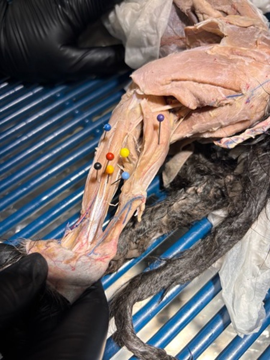 <p>What muscle of the shank is the orange pin in</p>