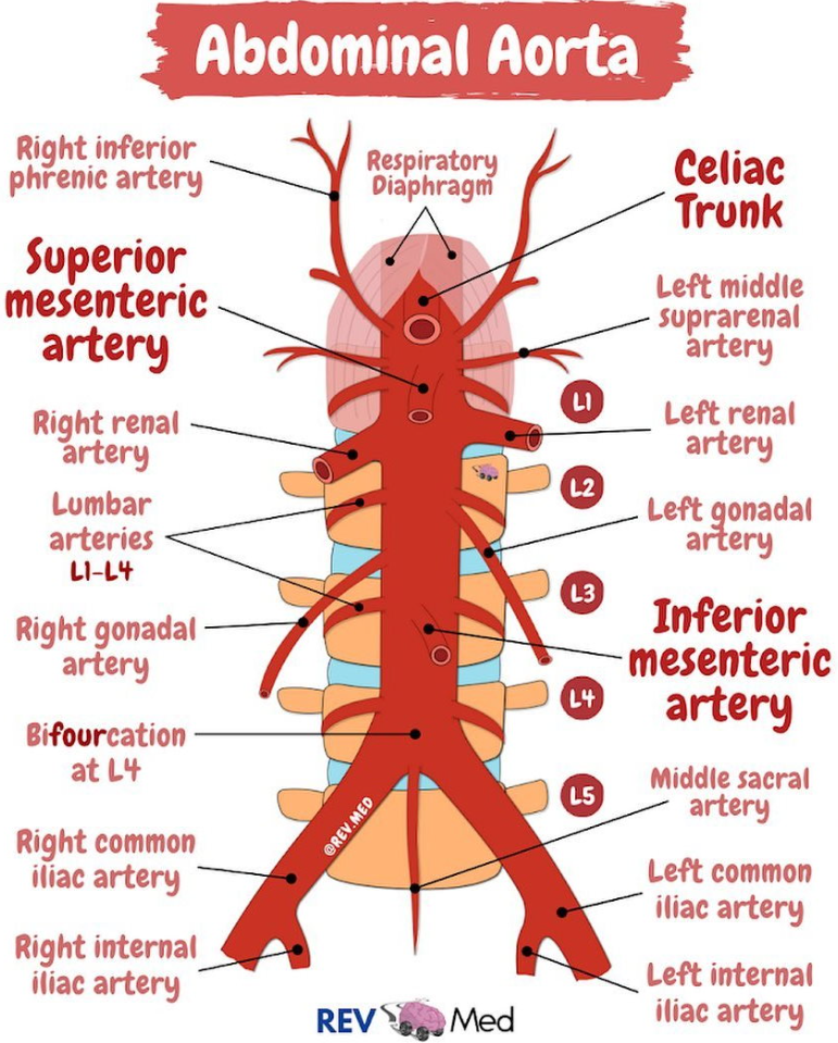 <p><span data-name="red_circle" data-type="emoji">🔴</span> <strong>Abdominal Aorta</strong></p><ul><li><p><mark data-color="red" style="background-color: red; color: inherit">Continuation of the </mark><strong><mark data-color="red" style="background-color: red; color: inherit">thoracic aorta</mark></strong><mark data-color="red" style="background-color: red; color: inherit"> beginning at the </mark><strong><mark data-color="red" style="background-color: red; color: inherit">aortic hiatus of the diaphragm (T12)</mark></strong></p></li><li><p><mark data-color="red" style="background-color: red; color: inherit">Descends </mark><strong><mark data-color="red" style="background-color: red; color: inherit">anterior to the vertebral column</mark></strong></p></li><li><p><mark data-color="red" style="background-color: red; color: inherit">Ends at the level of </mark><strong><mark data-color="red" style="background-color: red; color: inherit">L4</mark></strong><mark data-color="red" style="background-color: red; color: inherit">, where it bifurcates into the </mark><strong><mark data-color="red" style="background-color: red; color: inherit">right and left common iliac arteries</mark></strong></p></li></ul><p><span data-name="bricks" data-type="emoji">🧱</span> <strong>Paired Visceral Branches</strong> </p><p>(Supply internal <strong>organs</strong>)</p><p> 1. <strong><mark data-color="red" style="background-color: red; color: inherit">Middle Suprarenal Arteries</mark></strong><mark data-color="red" style="background-color: red; color: inherit"> </mark></p><ul><li><p>Arise at level <strong>L1</strong></p></li><li><p>Supply <strong>adrenal (suprarenal) glands</strong></p></li></ul><p> 2. <strong><mark data-color="red" style="background-color: red; color: inherit">Renal Arteries</mark></strong><mark data-color="red" style="background-color: red; color: inherit"> </mark></p><ul><li><p>Arise at level <strong>L1–L2</strong> (just below SMA)</p></li><li><p>Pass laterally to each <strong>kidney</strong></p></li><li><p>Right renal artery is longer and passes <strong>behind the inferior vena cava (IVC)</strong></p></li></ul><p> 3. <strong><mark data-color="red" style="background-color: red; color: inherit">Gonadal Arteries</mark></strong><mark data-color="red" style="background-color: red; color: inherit"> </mark></p><ul><li><p><strong>Testicular arteries</strong> (males) / <strong>Ovarian arteries</strong> (females)</p></li><li><p>Arise at level <strong>L2</strong>, below renal arteries</p></li><li><p>Descend along <strong>psoas major</strong> muscle into pelvis</p></li><li><p>Testicular arteries enter <strong>inguinal canal</strong>, ovarian arteries go to <strong>ovary and uterine tube</strong></p></li></ul><p><span data-name="bricks" data-type="emoji">🧱</span> <strong>Parietal (Lateral &amp; Posterior) Branches</strong> </p><p>(Supply <strong>body wall, muscles, vertebrae</strong>)</p><p> 1.<mark data-color="red" style="background-color: red; color: inherit"> </mark><strong><mark data-color="red" style="background-color: red; color: inherit">Inferior Phrenic Arteries</mark></strong><mark data-color="red" style="background-color: red; color: inherit"> </mark></p><ul><li><p>First paired branches, arise just <strong>below diaphragm at T12</strong></p></li><li><p>Supply the <strong>diaphragm</strong> and give <strong>superior suprarenal branches</strong> to adrenal glands</p></li></ul><p> 2. <strong><mark data-color="red" style="background-color: red; color: inherit">Lumbar Arteries</mark></strong><mark data-color="red" style="background-color: red; color: inherit"> (usually 4 pairs) </mark></p><ul><li><p>Arise from <strong>posterolateral surface</strong> of aorta at <strong>L1–L4</strong></p></li><li><p>Supply <strong>posterior abdominal wall muscles, skin, vertebrae, and spinal cord</strong></p></li></ul><p> 3. <strong><mark data-color="red" style="background-color: red; color: inherit">Median Sacral Artery</mark></strong><mark data-color="red" style="background-color: red; color: inherit"> (unpaired but related) </mark></p><ul><li><p>Small artery arising near <strong>aortic bifurcation (L4)</strong></p></li><li><p>Descends in midline over sacrum</p></li><li><p>Supplies <strong>sacrum, coccyx</strong>, and lower vertebral column</p></li></ul><p><span data-name="warning" data-type="emoji">⚠</span> <strong>Clinical Note</strong> </p><ul><li><p><strong>Abdominal aortic aneurysm (AAA)</strong> often occurs <strong>below renal arteries</strong></p></li><li><p><strong>Renal artery stenosis</strong> may lead to <strong>secondary hypertension</strong></p></li><li><p>Paired arteries must be carefully identified in <strong>abdominal surgery</strong> (e.g. nephrectomy)</p></li></ul><p></p>