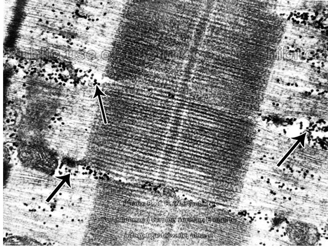 <p>Identify </p><p>Mention the type </p><p>Name the organ </p>