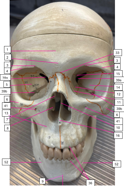 <p>39a + F</p>