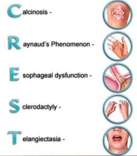 <p>What is another name for CREST syndrome?</p>