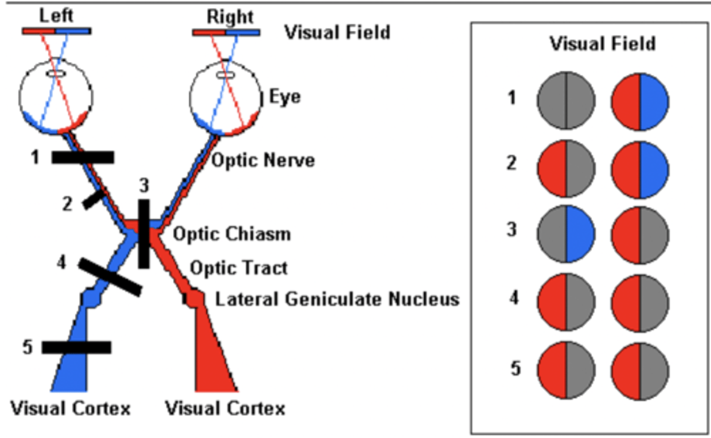 <p>Inability to see through the left eye <br>(#1)</p>