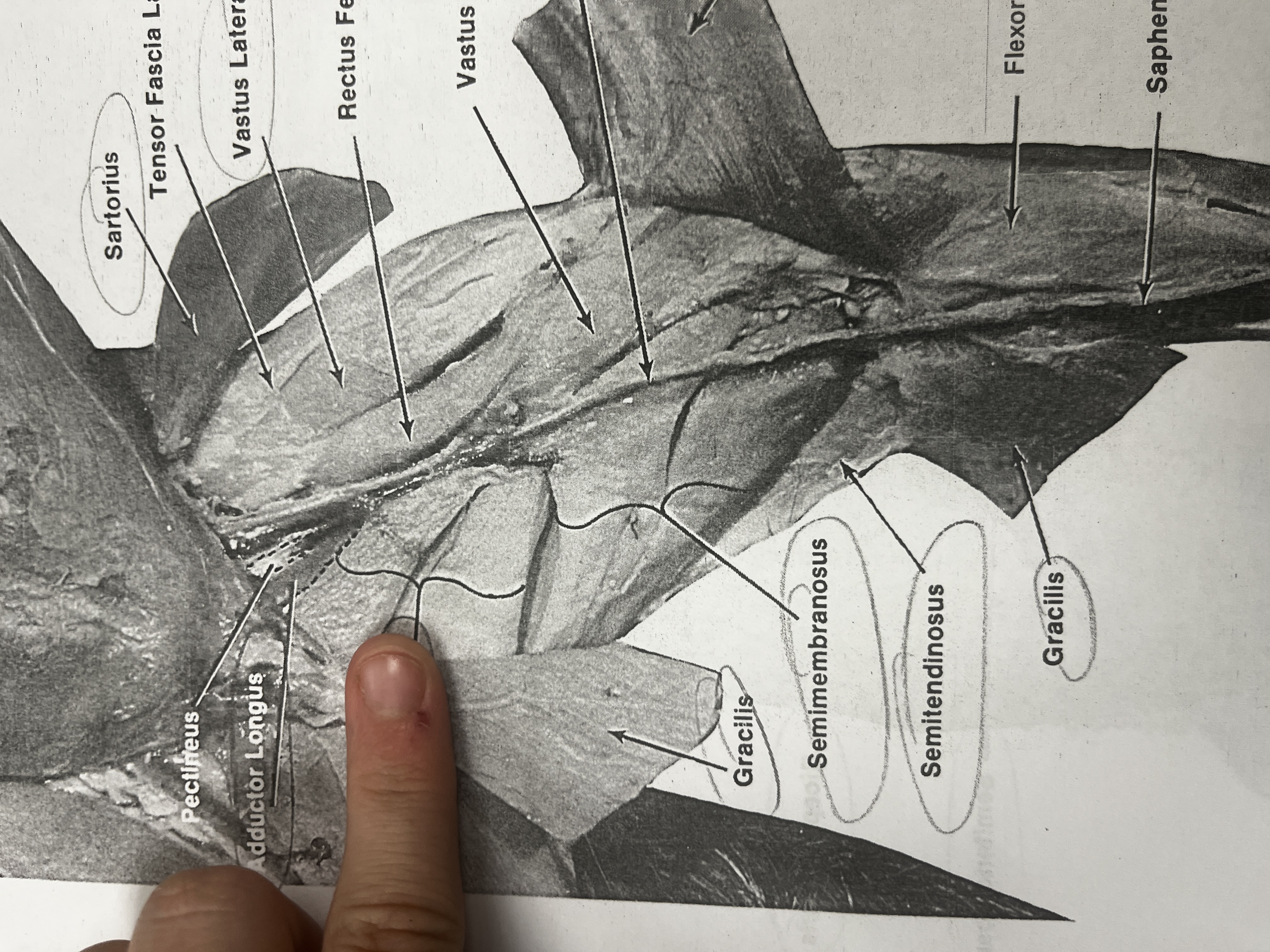 <p>A muscle that contributes to the adduction of the femur in the thigh.</p>