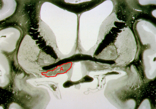 <p>What is structure “A”?</p>