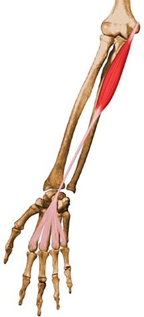 <p>origin: medial epicondyle of humerus<br>insertion: palmar aponeurosis<br>action: flexion at wrist</p>