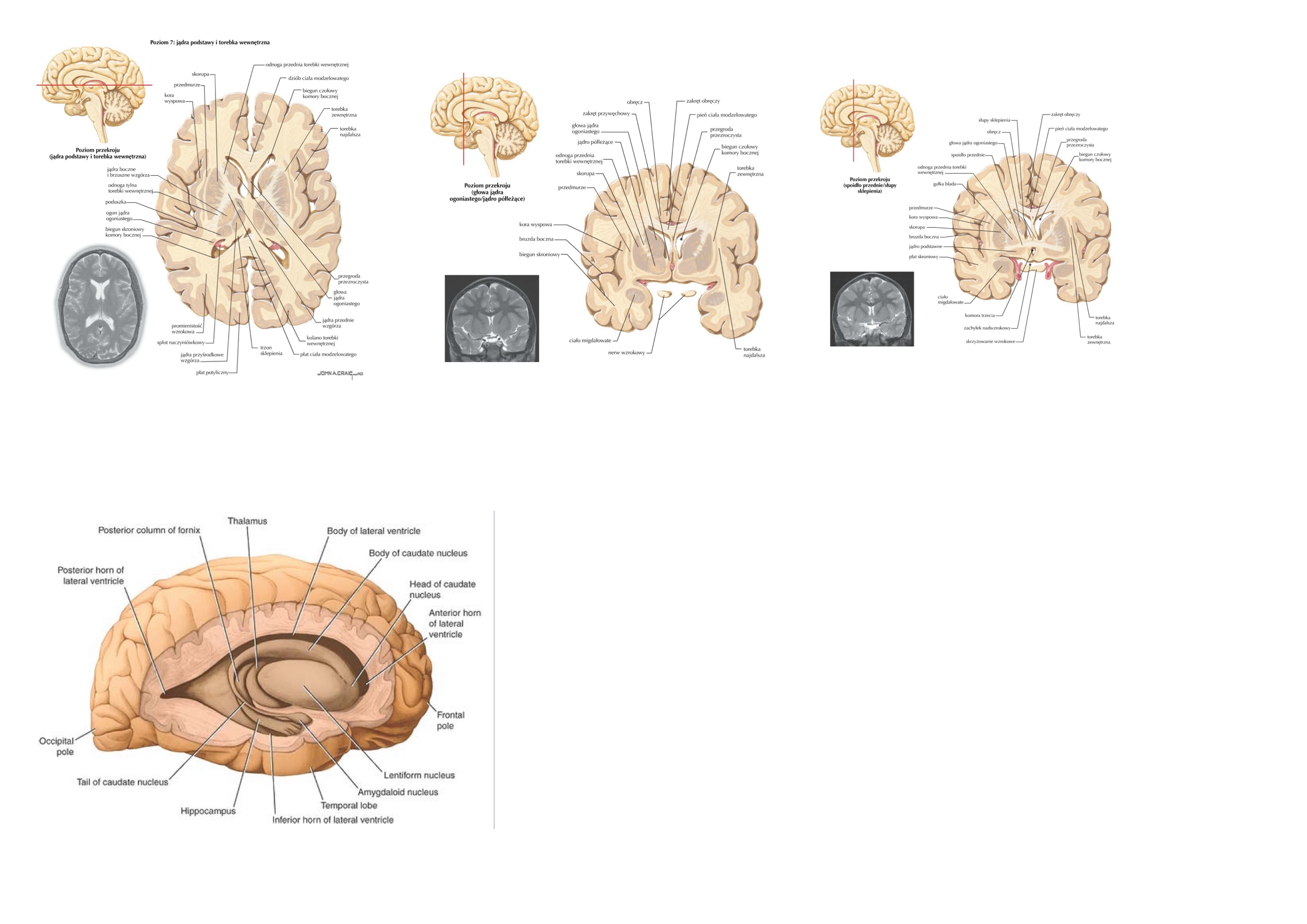 <p>blaszkę&nbsp;rdzenną boczną&nbsp;(lateral medullary lamina)</p>
