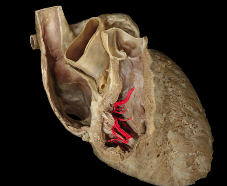 term image